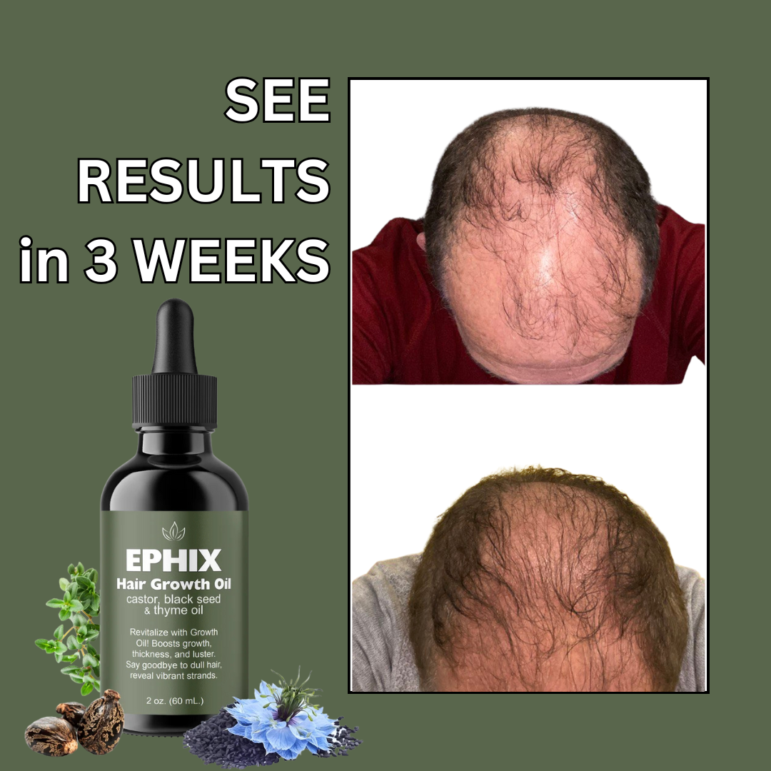 EPHIX Hair Growth Oil with Castor, Black Seed, and Thyme Oil